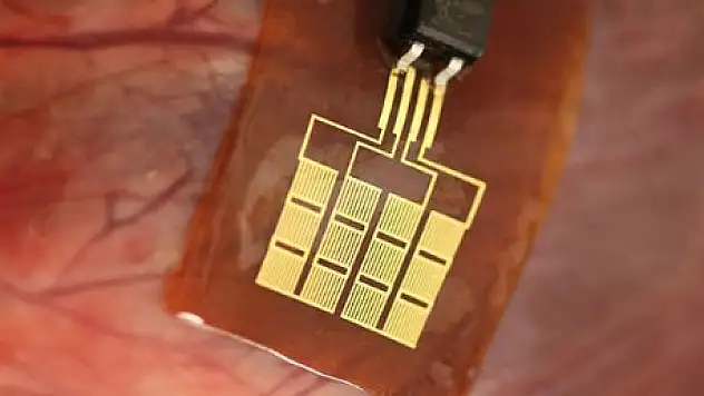 Mikroçip ile EKG Devri Başladı