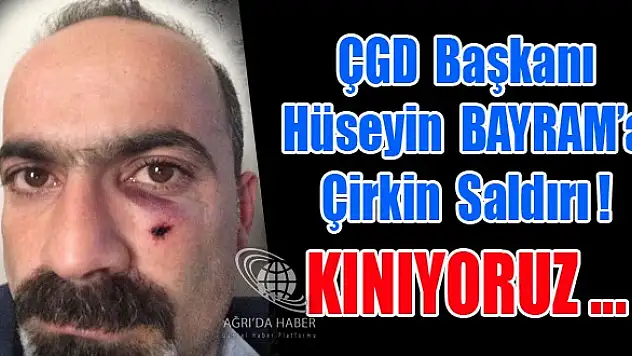 Ağrı'da Basına Çirkin Saldırı