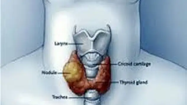 Nodüler Guart