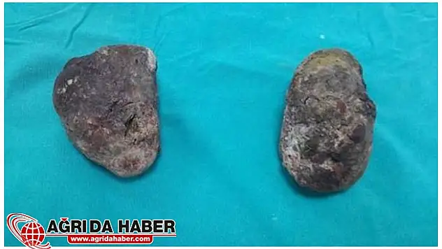 1,5 Kilo Trabzon Hurması Yedi Hastanelik Oldu !