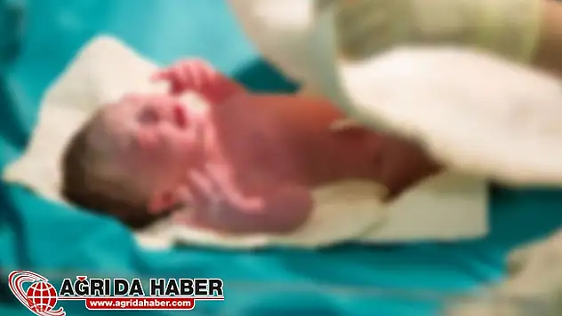 Hindistan'da Denizkızı Sendromlu Bebek 4 Saat Sonra Öldü !