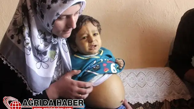 Şerzan Bebek Karaciğer Nakli Bekliyor