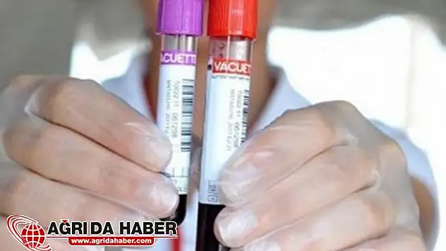 Nikahtan Önce HIV Testleri Zorunlu Olsun Tartışması