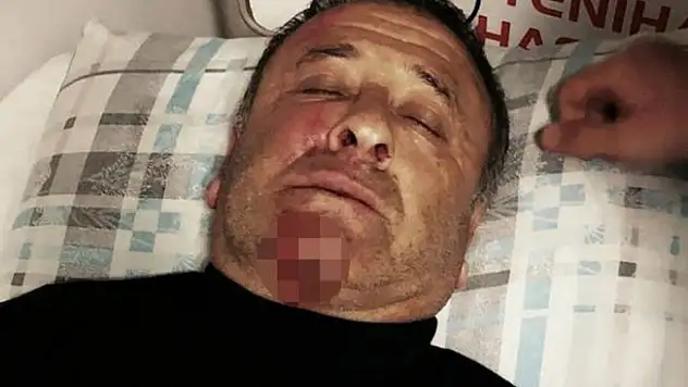 Eski futbolcu saldırıya uğradı