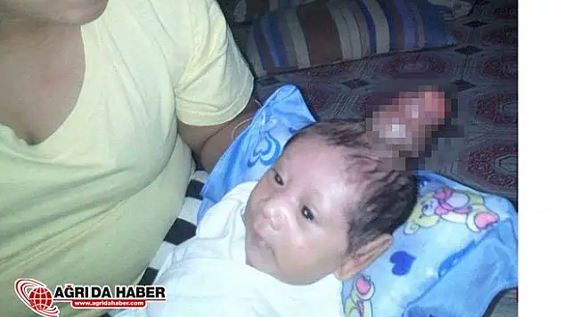 Filipinlerde Doğan Boynuzlu Bebek Görenleri Çok Şaşırttı!