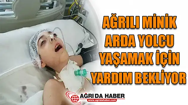Ağrılı Minik Arda Yaşamak İçin Yardım Bekliyor