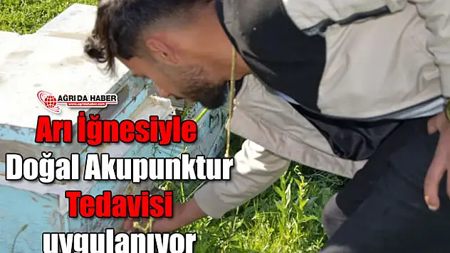 Ağrı'da Arı İğnesiyle Akupunktur Tedavisi Uygulanıyor!
