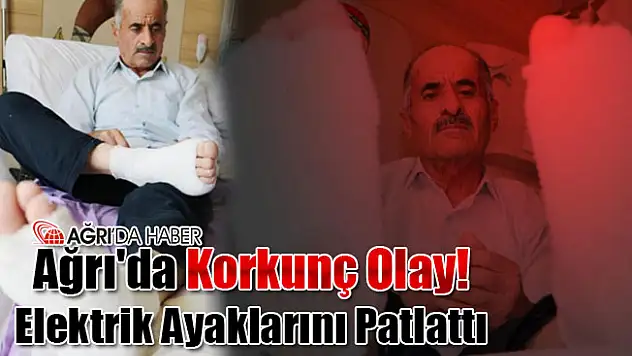 Ağrı'da korkunç olay! Elektrik Ayaklarını Patlattı