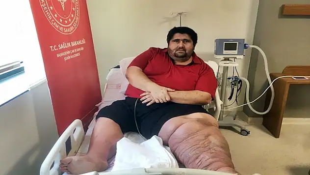 300 Kiloluk hasta kilo vermeye başladı