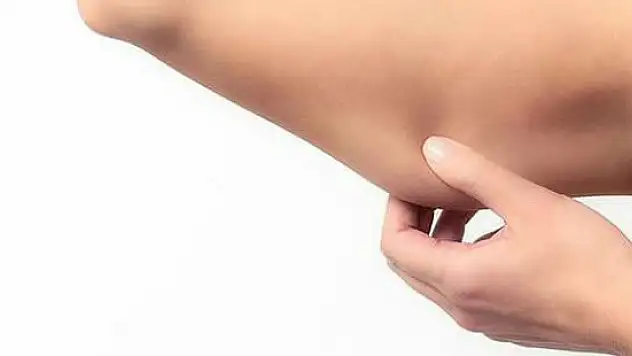 Yazın bu ameliyatına talep artıyor