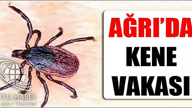 ELEŞKİRT TE KENE VAKASI