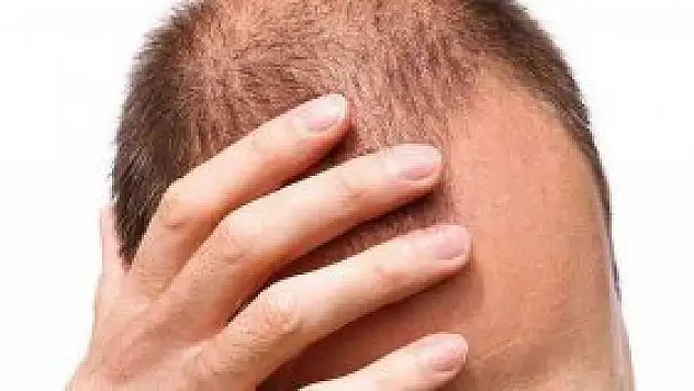 Yaz mevsimine özel 7 saç bakımı önerisi