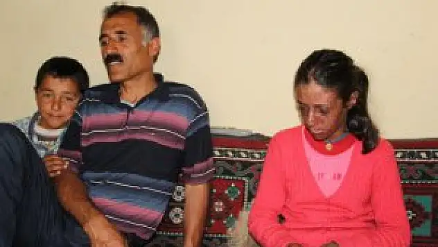 Kaymakam Büyükköse, sedef hastası çocuğa sahip çıktı