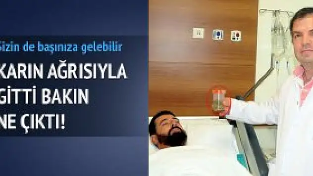 Safra kesesinden 512 taş çıktı