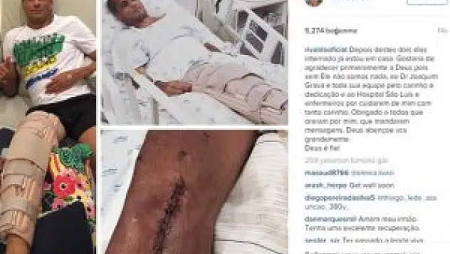 Rivaldo Ameliyatlı Ayağının Resmini Paylaştı