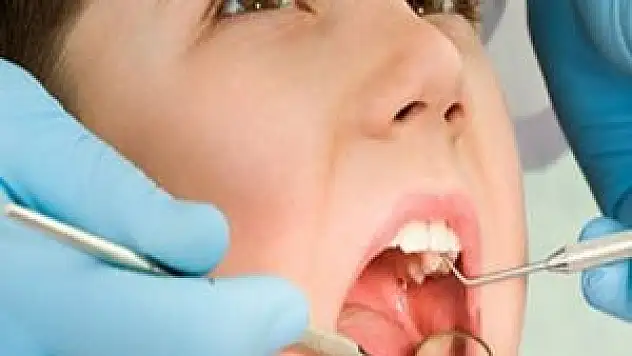 Sağlıklı diş için çocuklar 6 ayda bir kontrol ettirilmeli!