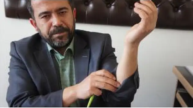 28 Şubat'ın 'İzlerini' Vücudunda Taşıyor