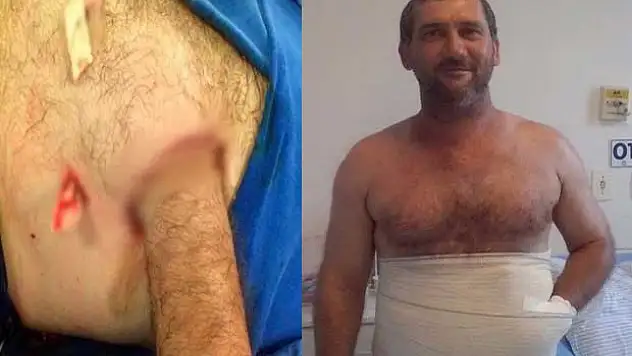 Carlos Mariotti'nin Kopan Kolunu Karnına Diktiler! Şaşırtan Ameliyattan Detaylar