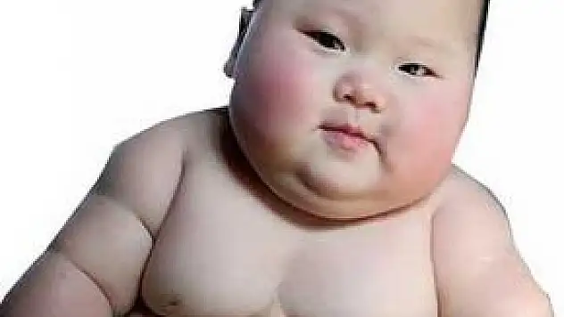 Türkiyedeki kadınların %34 ü obez