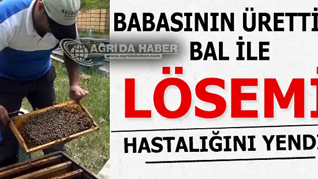 Lösemiyi Organik Bal İle Yendi! Baba Elinde Yapılan Bal Şifa Oldu