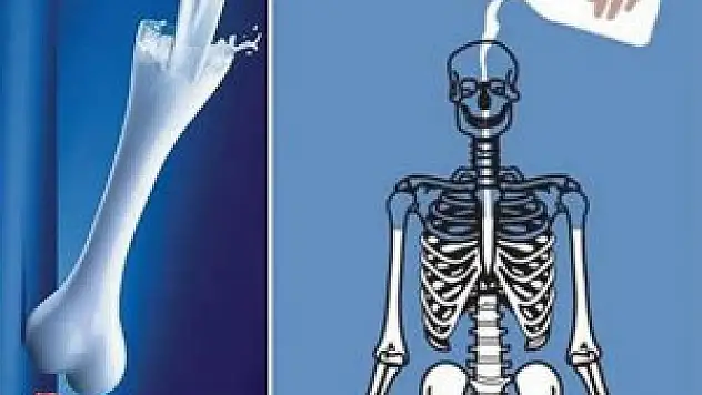 Kemik Erimesi İçin D3 Vitamini Almayı Unutmayın