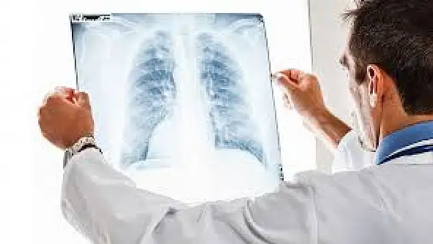 Akciğer kanseri erkeklerde en sık görülen kanser türü açıklandı ?