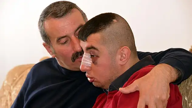 Erzurum'da Zihinsel engelli Gence 12 Dakika Boyunca Dayak Atıldı !