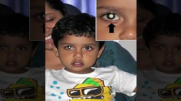 2 yaşındaki çocuk Fotoğraftaki ayrıntı kanseri ortaya çıkardı