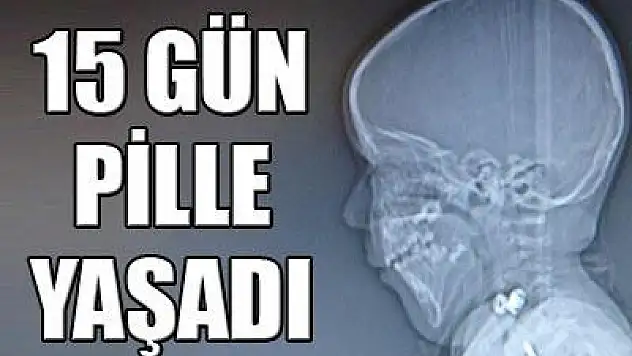 15 gün pille yaşadı