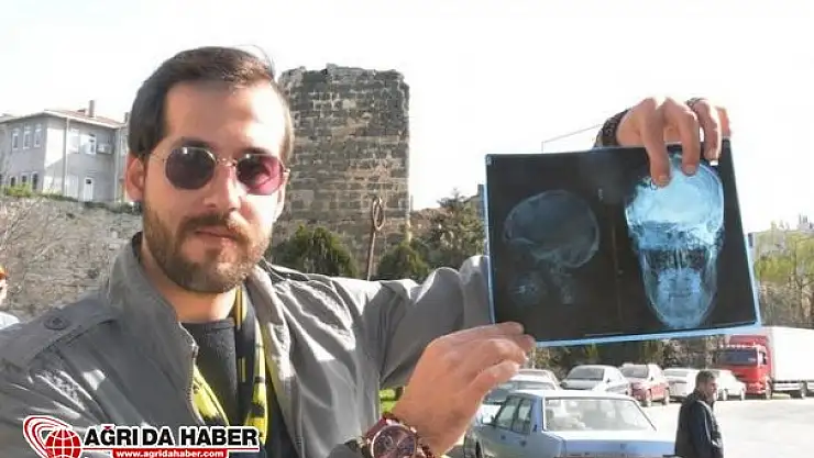 Sinop'ta Akıl Almaz Olay! Dişi Beyninden Çıktı!