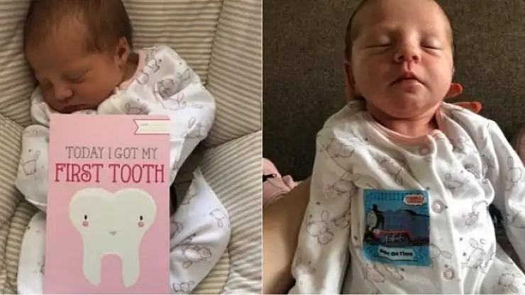 12 Günlük Bebek Ağzında Diş İle Doğdu