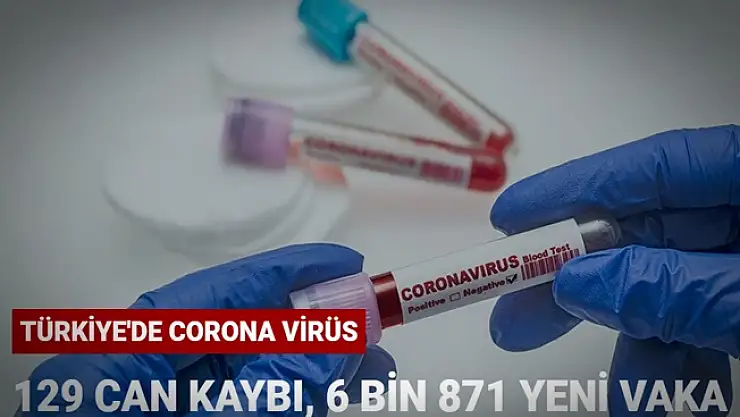 30 Ocak 2021 Koronavirüs tablosu 129 can kaybı, 6 bin 871 yeni vaka