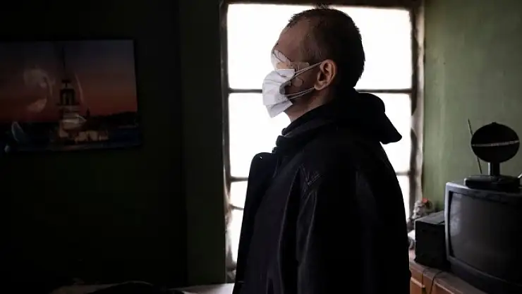 Cilt Kanseri Nedeniyle Yüzünü Kaybeden Baba'dan Duygusal Açıklama